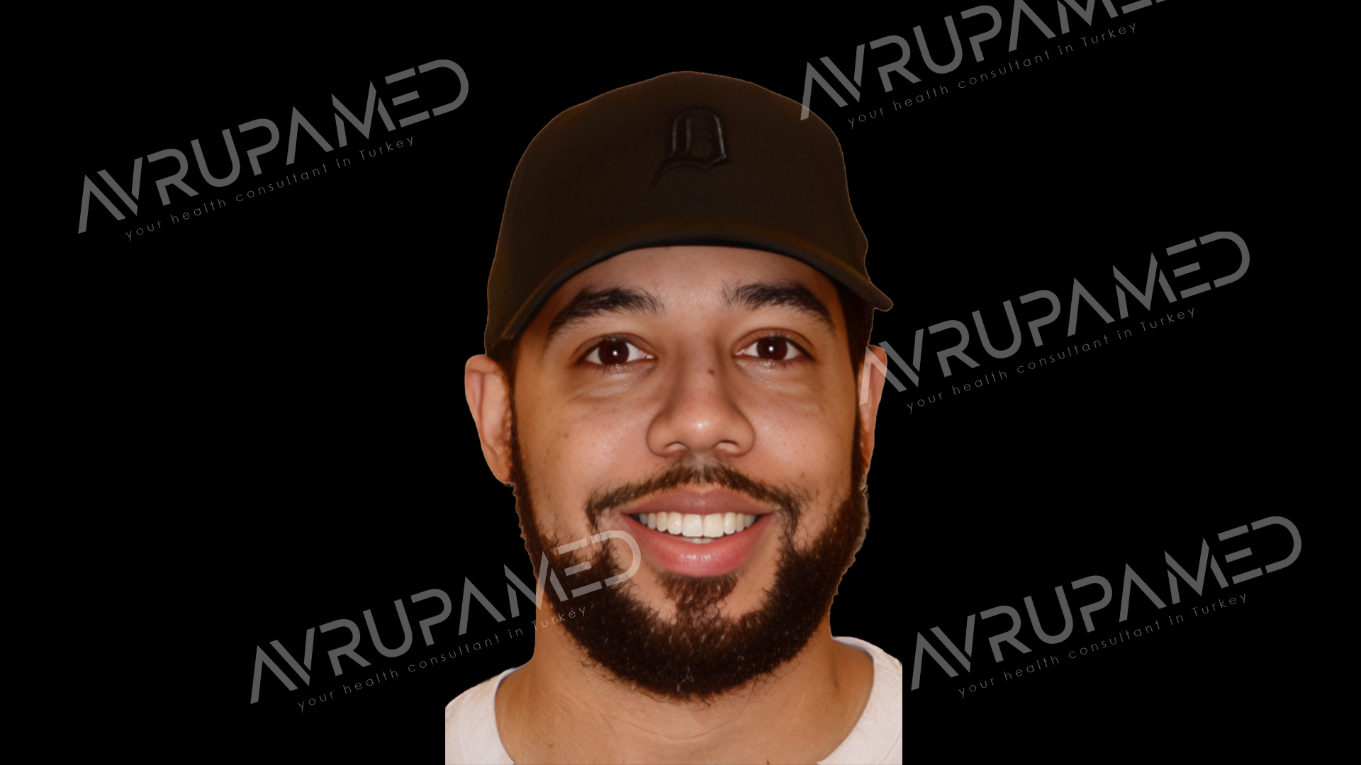 Hollywood Smile After Case 1